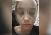 Избитая школьница из Забайкалья вышла на связь: «Стараюсь забыть»